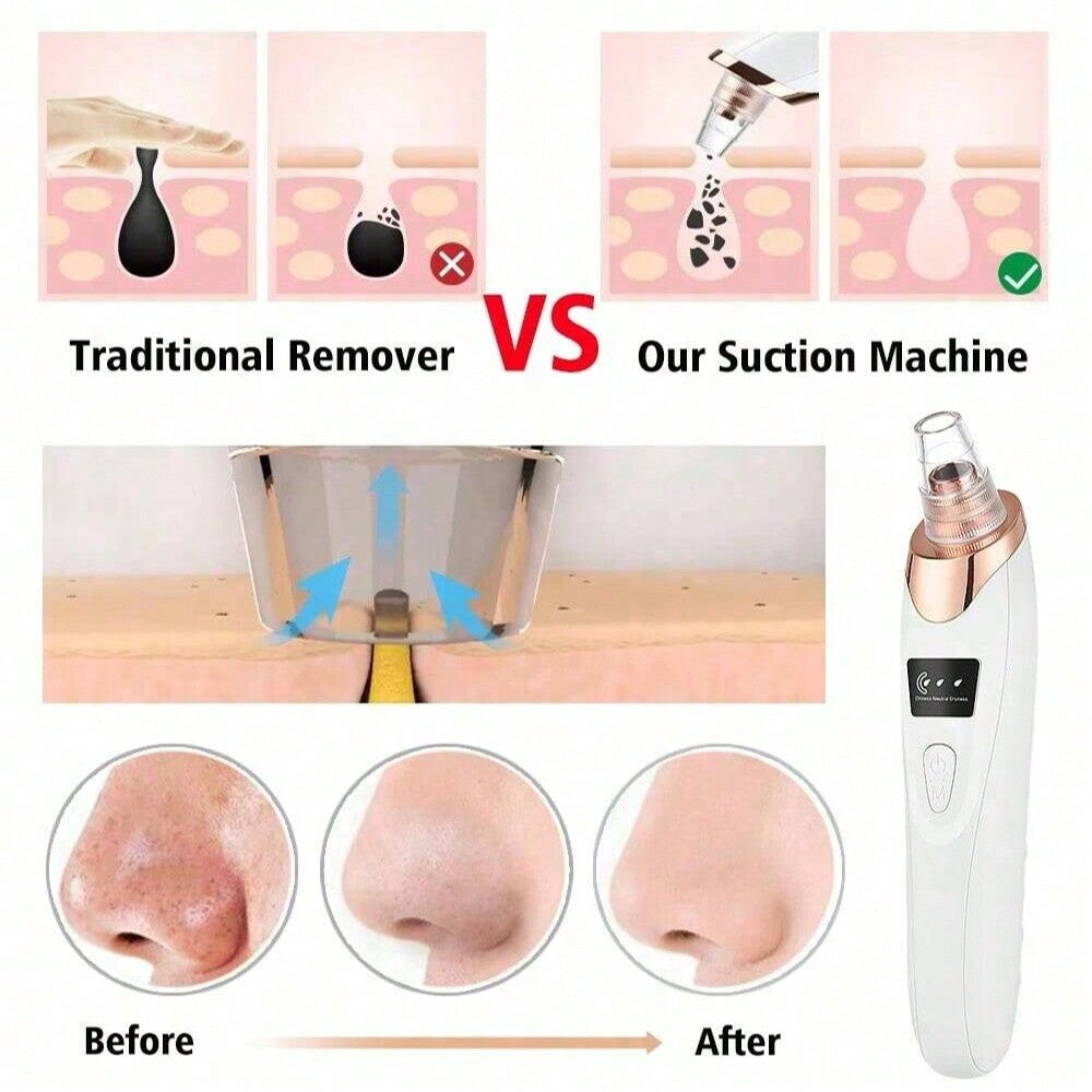 LUMIVIA™ – Electric Acne Pore Cleaner &amp; Blackhead Remover